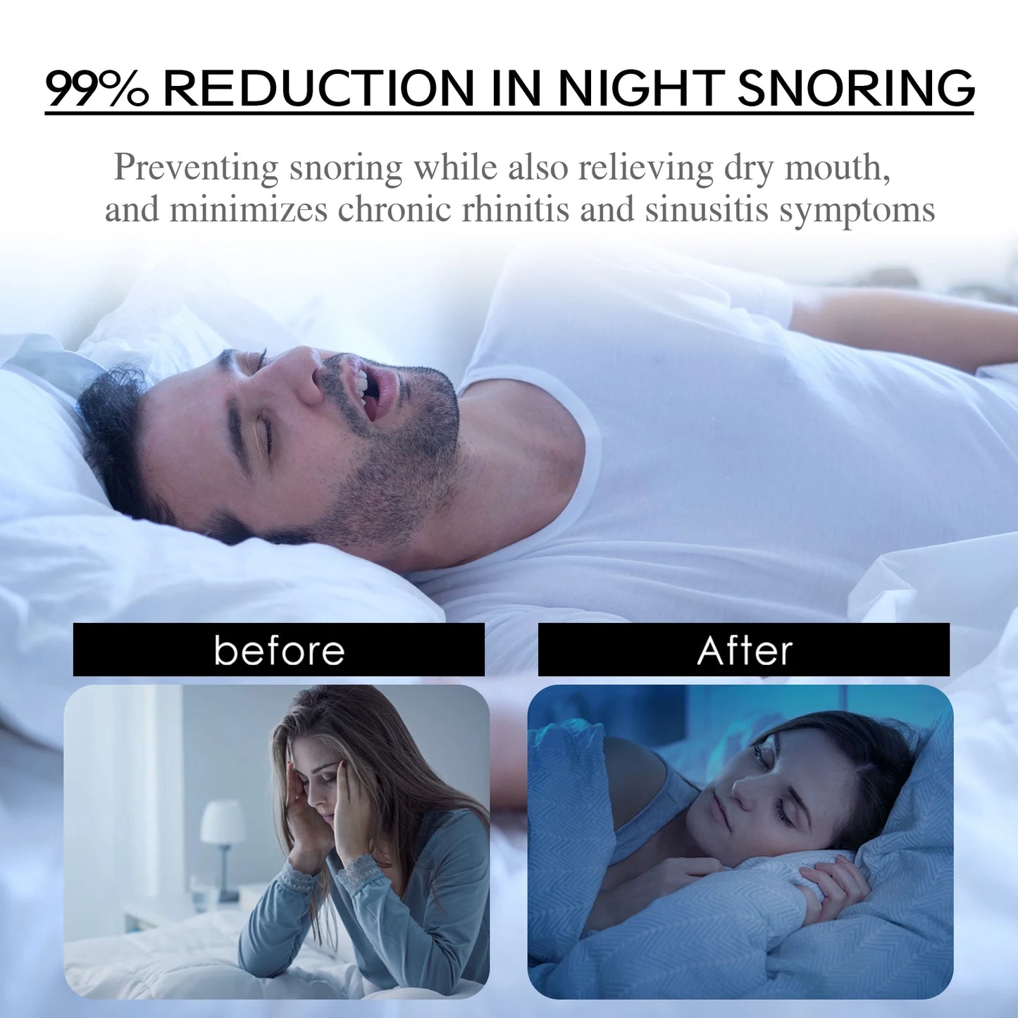 Stop Snoring Improve Sleeping Mouth Orthosis Tape